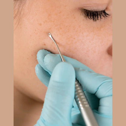 RUCK® Komedonenheber